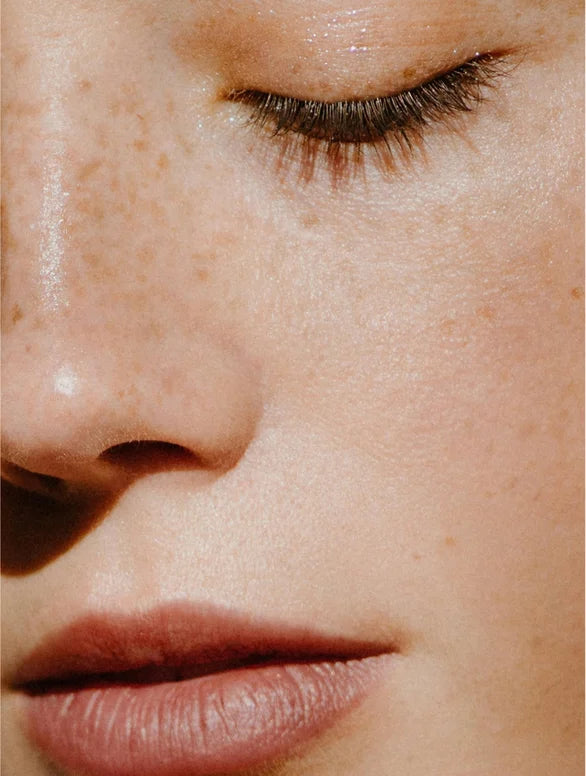 Acne Spot Care